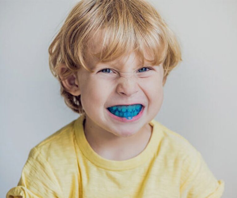 Invisalign vs. Myobrace: